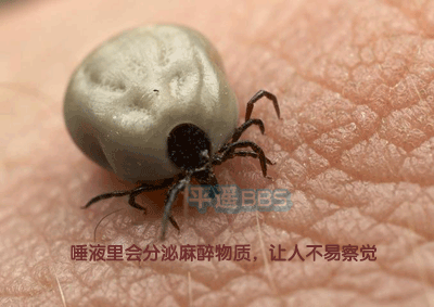 衛生部發布“蜱的特點及預防控制知識”