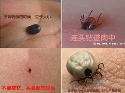衛生部發布“蜱的特點及預防控制知識”