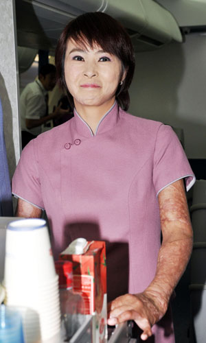 臺(tái)灣女孩遭燒傷從容生活 華航助圓“空姐夢(mèng)”