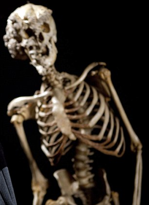 醫學“考古”將揭秘英國大象人怪癥[圖]