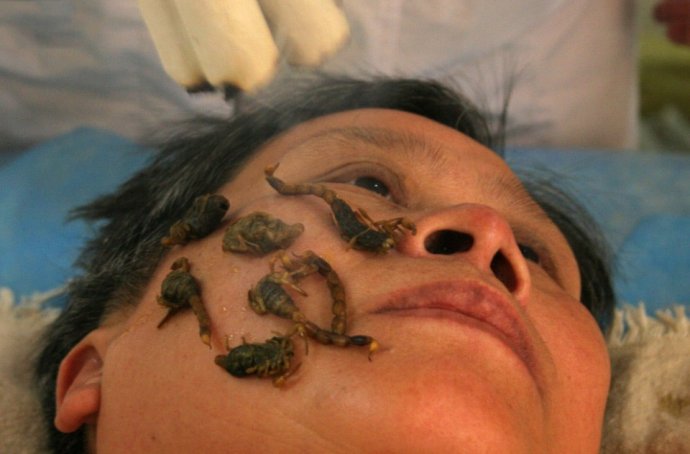 令人瞠目結(jié)舌的全球另類療法