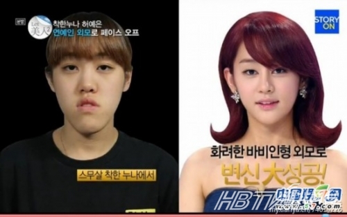 丑女變靚妹！韓國整容節目爆紅