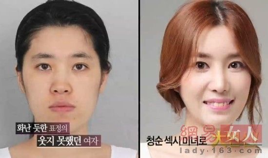 丑女變靚妹！韓國整容節目爆紅