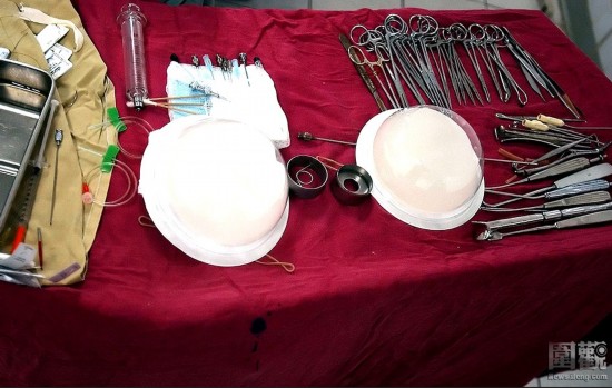 探秘國外令人觸目驚心的廉價整容