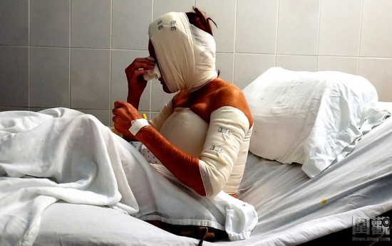 探秘國外令人觸目驚心的廉價整容