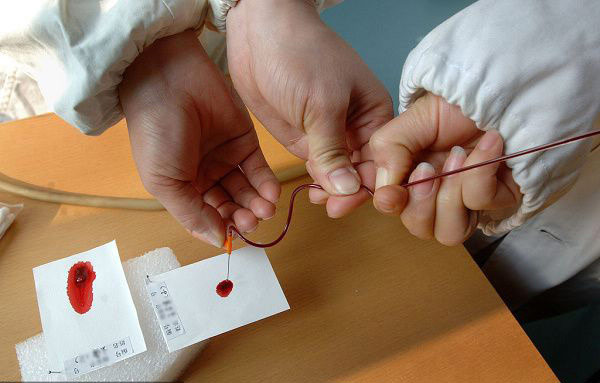 婚姻脆弱催熱親子鑒定 滴血認(rèn)親一再上演