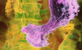 中以科學(xué)家推出新型胃癌診斷方法 呼吸測(cè)試即可確診