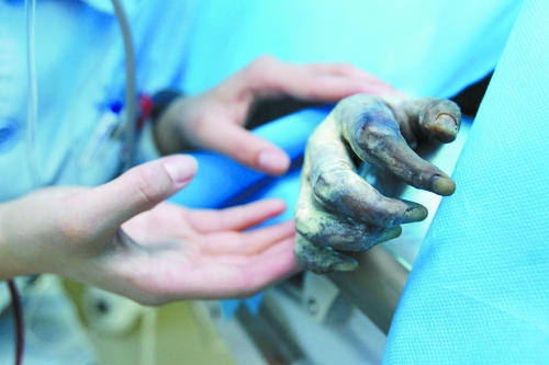 鄧州女孩火海救母引全國愛心爆發 母親欲割皮救女