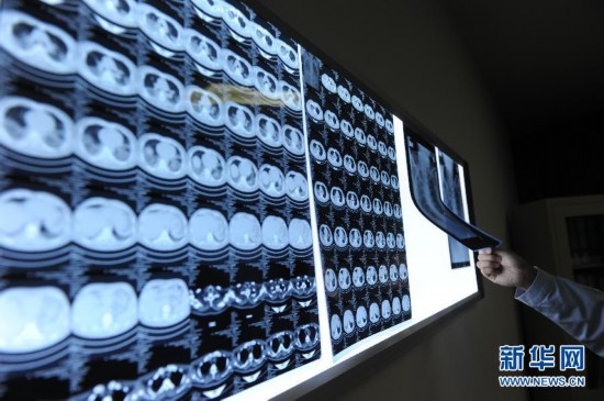 病前一周接觸過禽類者為感染H7N9高危人群