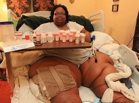 盤點(diǎn)全球令人無法想象的胖人