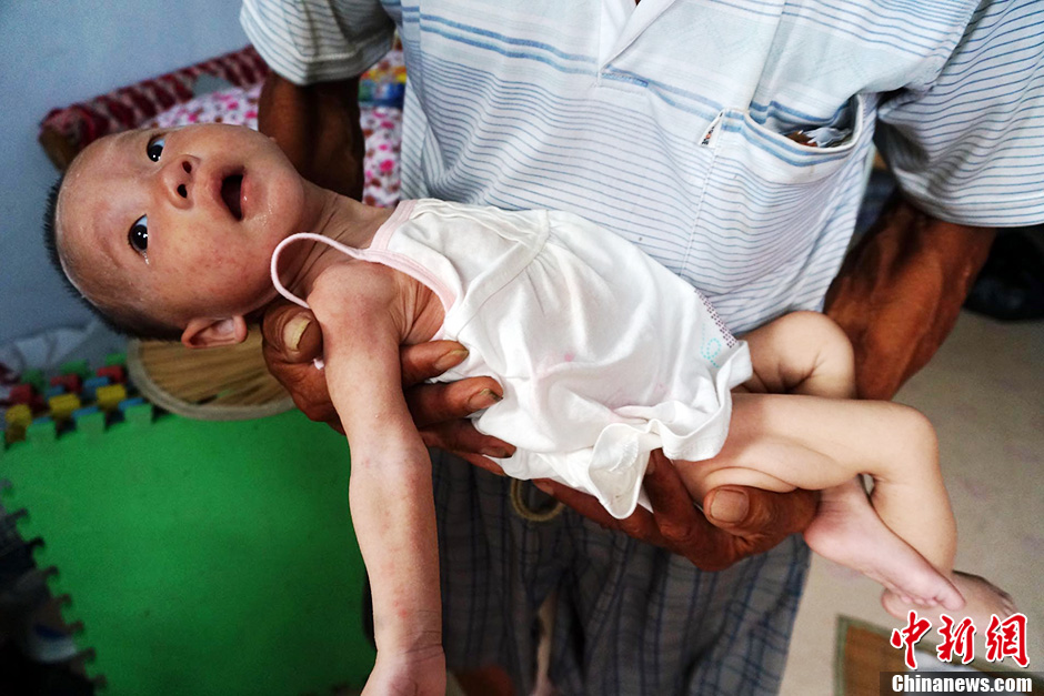 河南“饑餓娃娃”身體恢復(fù)良好 未來去向不定