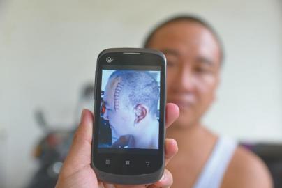 男子被父親酒后砍傷 向媒體自曝家丑(圖)