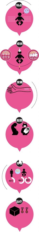 泉州女嬰事件牽出神秘病癥：被燙傷的SSSS