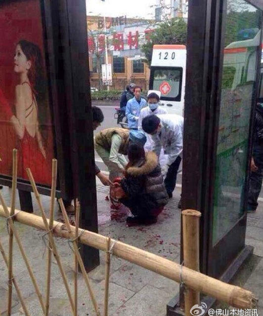 廣東佛山一女子等車遇搶劫被砍10多刀 雙手被砍爛