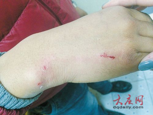 因在車上剪指甲引發糾紛 男子乘公交挨一螺絲刀(圖)