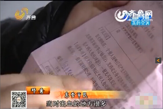 東營：男子與同事辦公室打架被咬臉 對方拒絕賠償