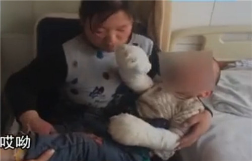 聊城兩歲半男孩雙手浸入油鍋 燙傷嚴重疼痛難耐
