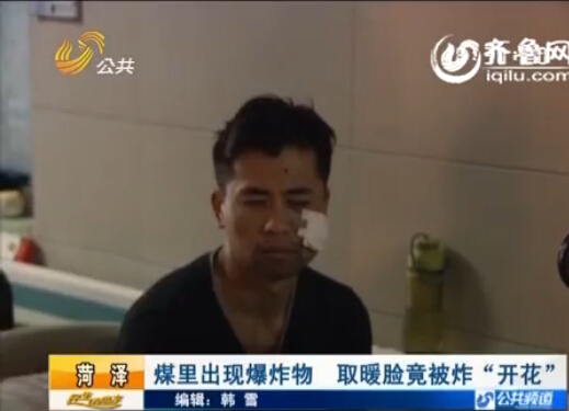 菏澤：煤里出現爆炸物 取暖臉竟被炸“開花”