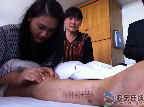 女孩以身擋車救人被撞 煙臺上演“最美”傳奇