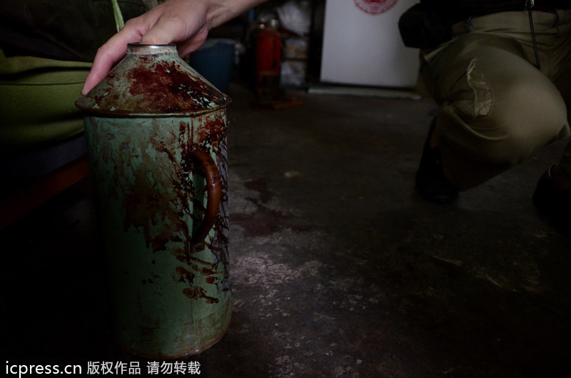 北京一老太因養狗起沖突 九旬奶奶被咬受傷