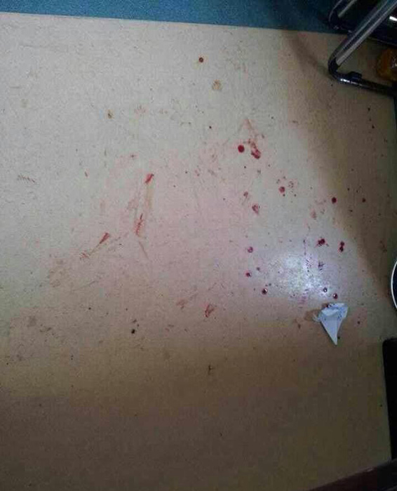 廣醫二院“抗非”英雄醫生被圍毆 因家屬欲運尸被拒