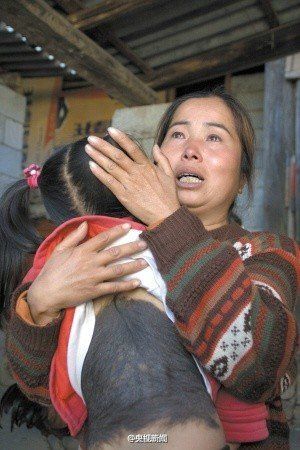 云南3歲女童長“毛毛背” 醫院查不出病因(圖)