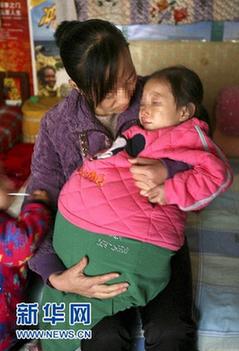 山西4歲女孩患恐怖腹水腫腹大如球 今赴京醫病