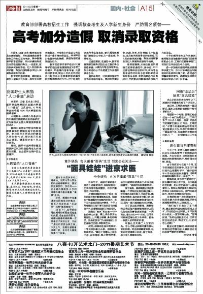 山西“面具娃娃”來京整容 不怕手術想“變漂亮”