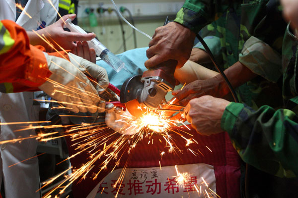 Critical procedure to remove iron bars in body