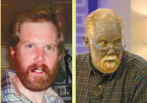 美國(guó)男子服藥產(chǎn)生副作用 變作”藍(lán)精靈“