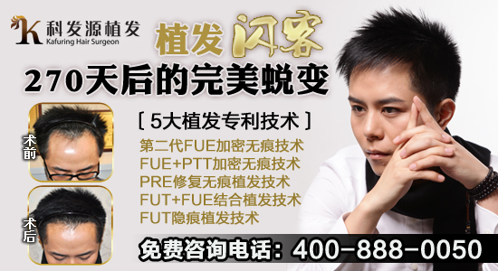 脫發(fā)的原因有哪些？科發(fā)源揭秘脫發(fā)三大原因