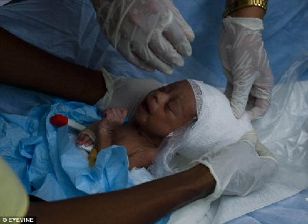 海地災區上演生命奇跡 約3周大女嬰成功獲救