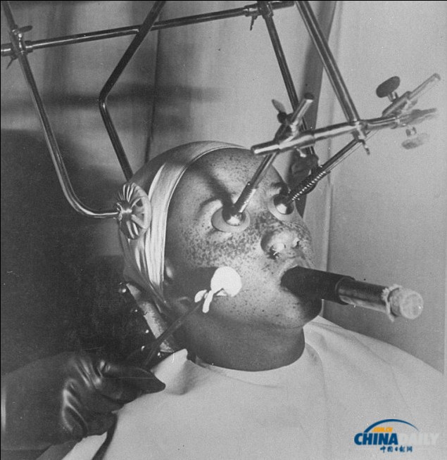 加熱美膚帽、冰凍祛斑機(jī) 圖說(shuō)上世紀(jì)“恐怖”美容法