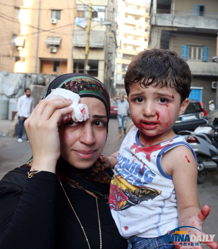 黎巴嫩貝魯特發生汽車爆炸 至少21死200多傷