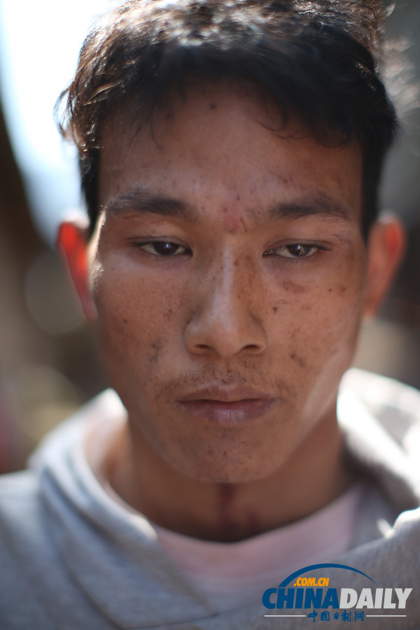 緬甸克欽拉咱：生活在安置點(diǎn)的民眾（組圖）