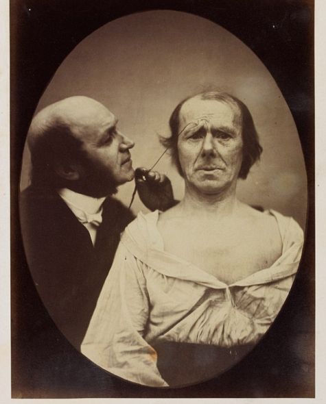 揭秘達爾文最后實驗:探索人類情緒表情扭曲