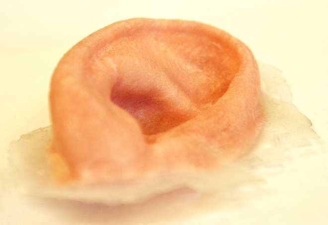 外部創傷患者福音：3-D打印鼻子、耳朵誕生