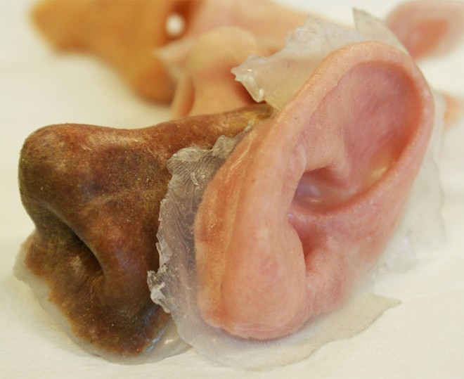 外部創傷患者福音：3-D打印鼻子、耳朵誕生