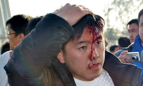 遼寧球迷被國安球迷打破頭 斑斑血跡滿面鮮血