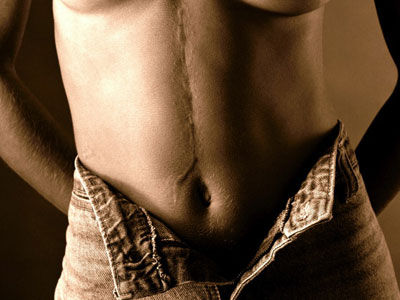 十種小病可能會要你的命(組圖)